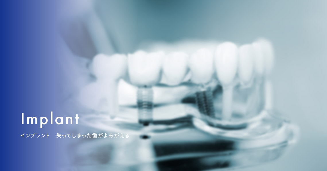 インプラント